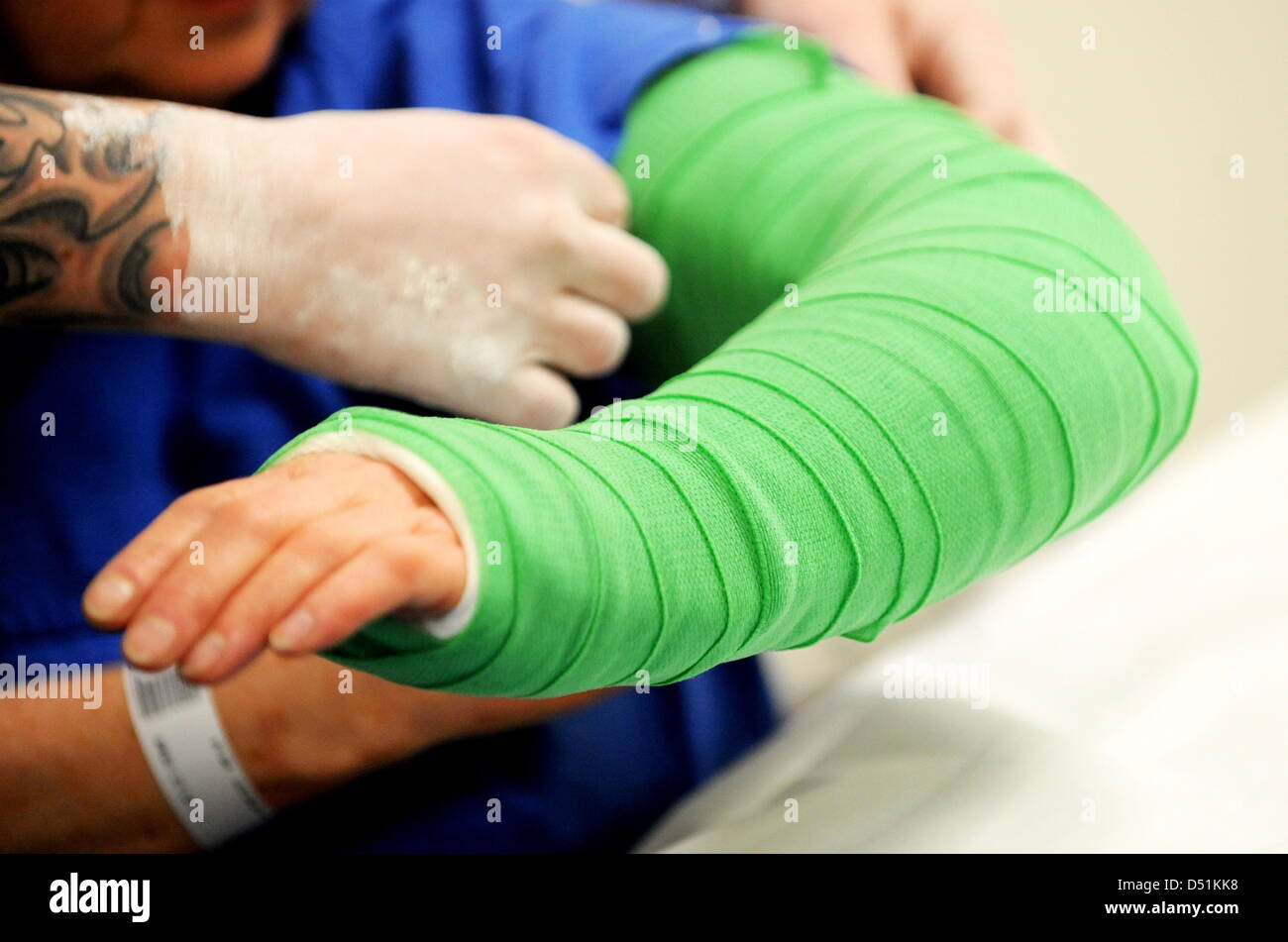(FILE) - A file picture dated 08 February 2010 shows a nurse putting an arm of a woman into a cast, who fell due to icy streets in Hamburg, Germany. A survey of the German Press Agency (dpa) of 21 December 2010 shows that medics have alot to do since the winter weather. Photo: Maurizio Gambarini Stock Photo