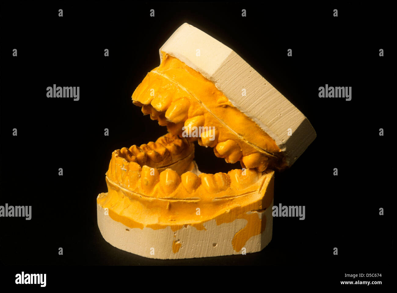 Dental Cast Model opened. Stock Photo