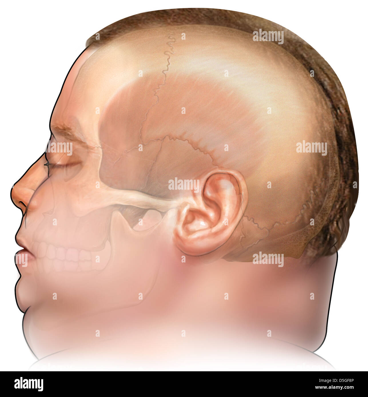 Lateral Head and Skull of Obese White Male Stock Photo