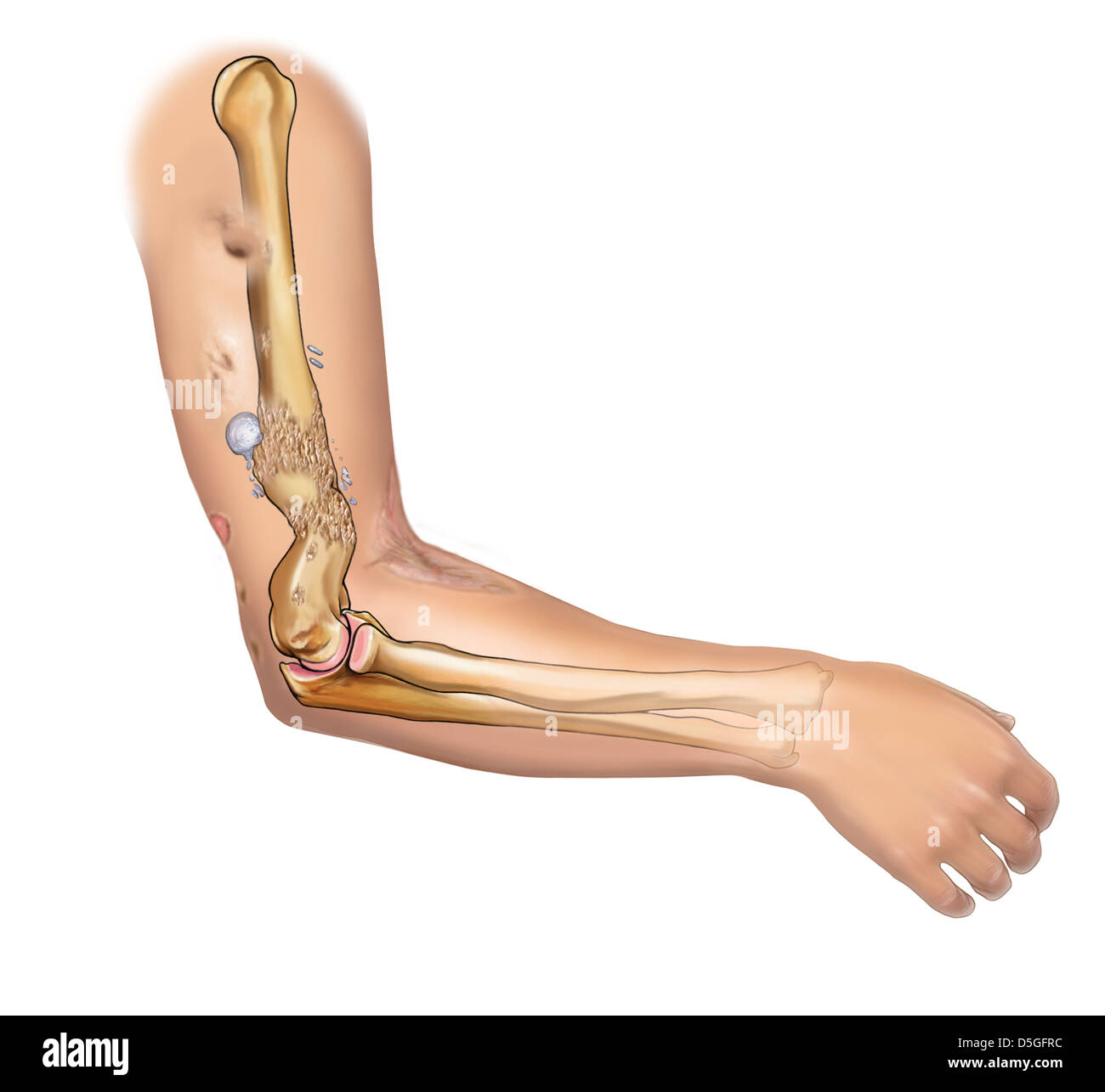 Bullet wound hires stock photography and images Alamy