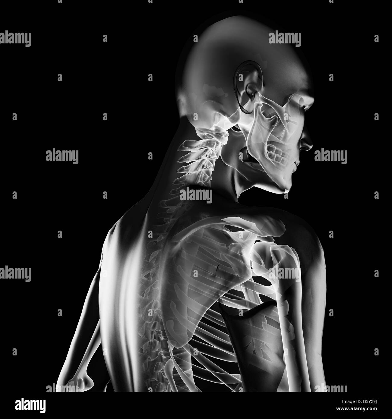 Xray scan Black and White Stock Photos & Images - Alamy
