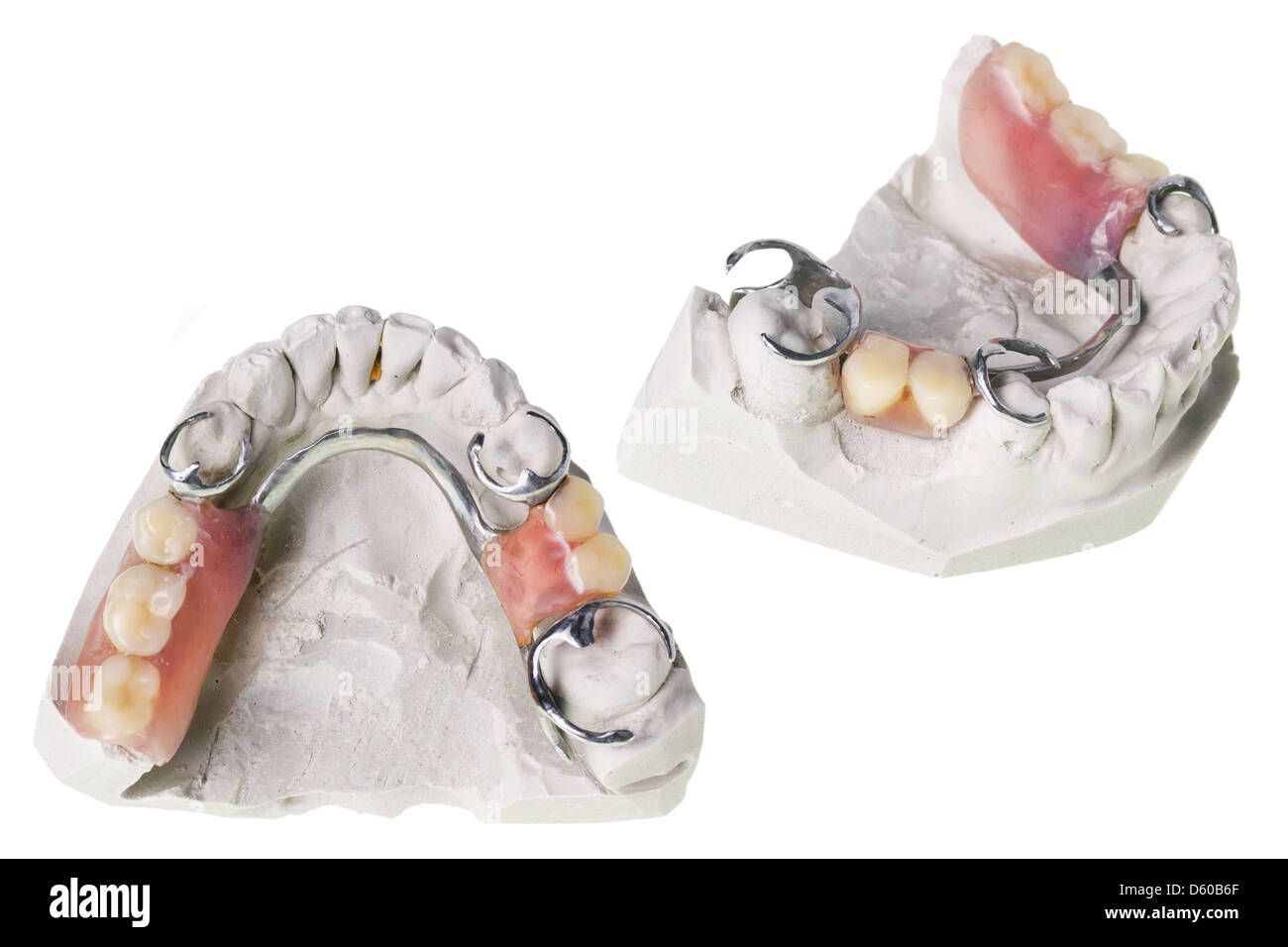 Plaster cast of  teeth and dentures Stock Photo