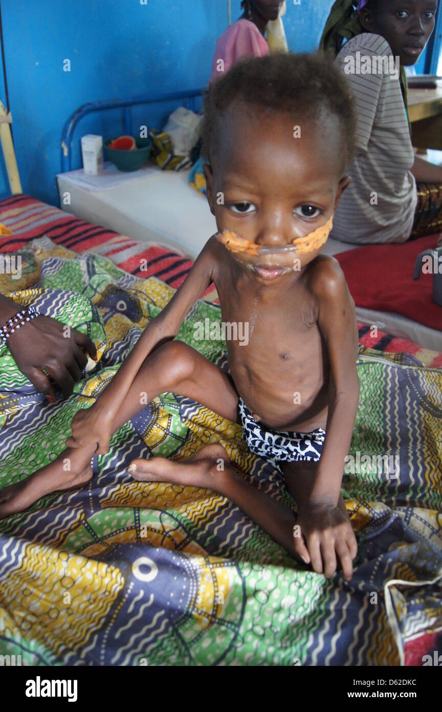 Emaciated