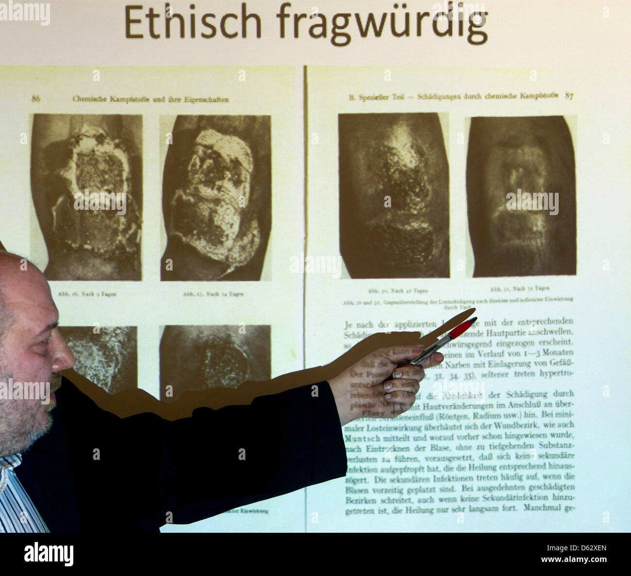 Henrik Eberle, historian at Martin Luther University Halle-Wittenberg, points to historic photos from experiments with chemical weapons in Greifswald, Germany, 11 April 2013. The most current research by historians shows that chemical weapons and their effects were researched and tested at Greifswald University under chemist Gerhart Jander and medical doctor Wilhelm Richter. Some of the experiments were carried out on humans. The university is researching the relationship its researchers had with the Nazi regime. Photo: STEFAN SAUER Stock Photo