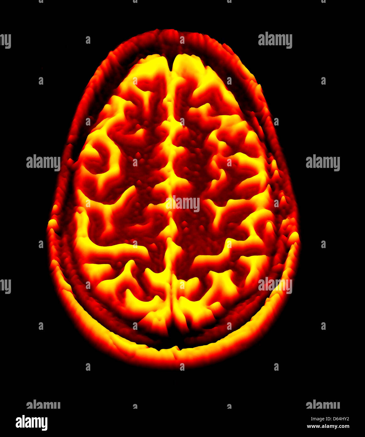 Brain scan, MRI scan, heightmap Stock Photo - Alamy