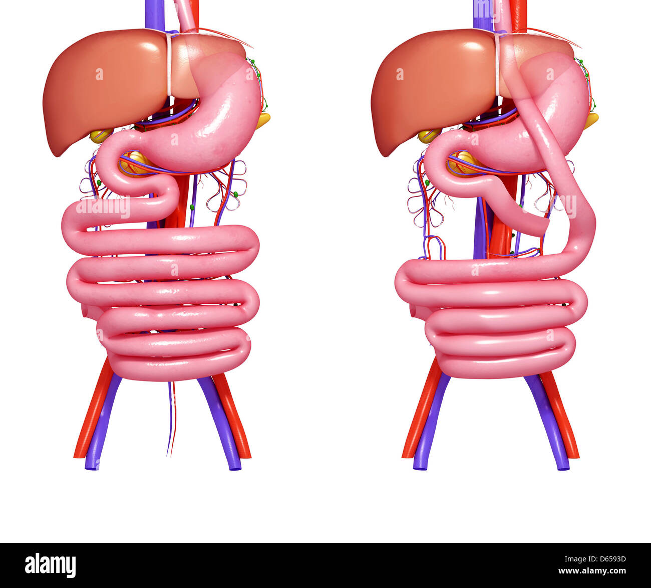 Gastric bypass procedure Cut Out Stock Images & Pictures - Alamy