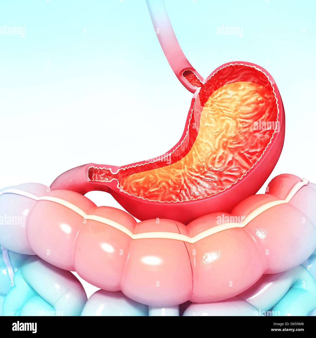 Хронический атрофический антральный гастрит. Хронический неатрофический эрозивный гастродуоденит. Атрофический гастрит патанатомия. Диффузный поверхностный гастробульбит. Диффузный желудок.