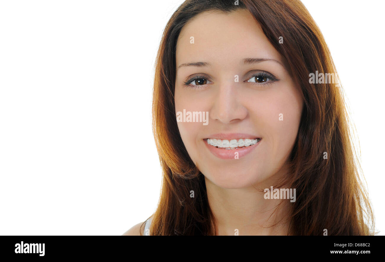 Teen girl with braces hi-res stock photography and images - Alamy