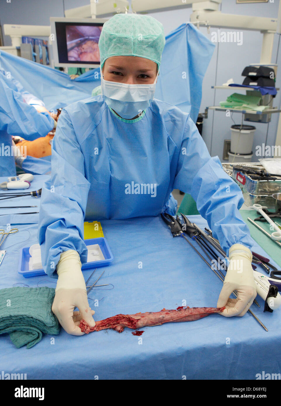 A nurse hold the small remaining part of the stomach during an operation at the University Medical Center (UKE) in Hamburg-Eppendorf, Germany, 24 July 2012. The University Obesity Center at the UKE was set up to be able to better help the increasing number of patients with morbid obesity with an interdisciplinary approach to treatment. Photo: GEORG WENDT Stock Photo