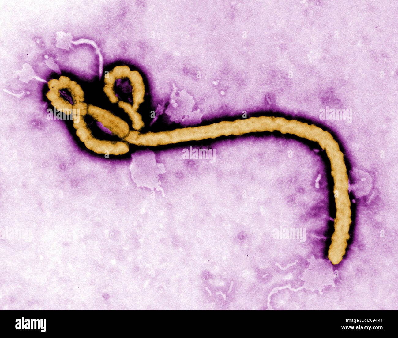HANDOUT - Created by CDC microbiologist Frederick A. Murphy, this colorized transmission electron micrograph (TEM) revealed some of the ultrastructural morphology displayed by an Ebola virus virion (undated image). Photo: Frederick Murphy/CDC (MANDATORY CREDIT; zu dpa: 'Bisher 14 Tote bei neuem Ebola-Ausbruch in Uganda')  +++(c) dpa - Bildfunk+++ Stock Photo