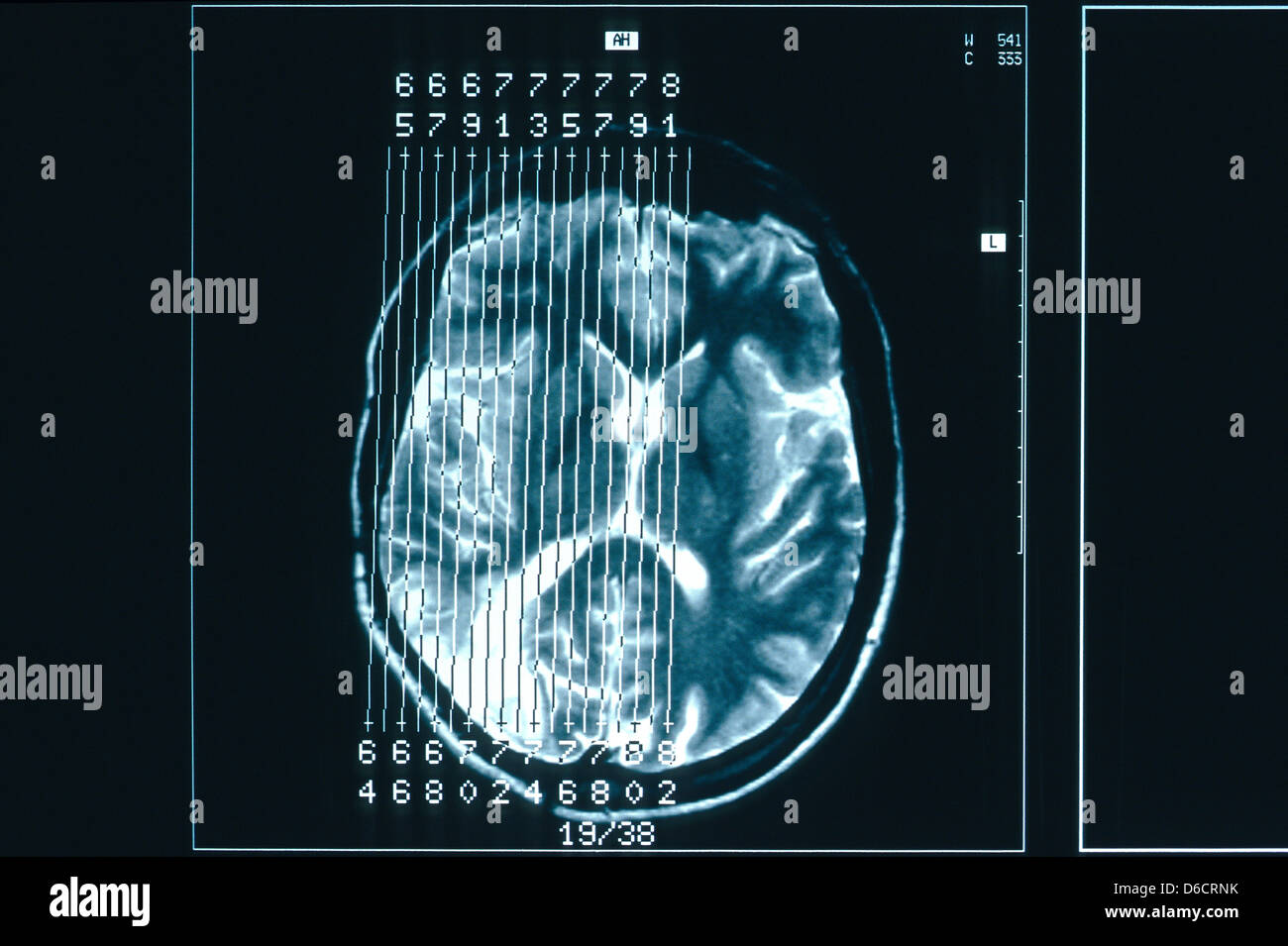 Berlin, Germany, MRI scan of a human head Stock Photo Alamy