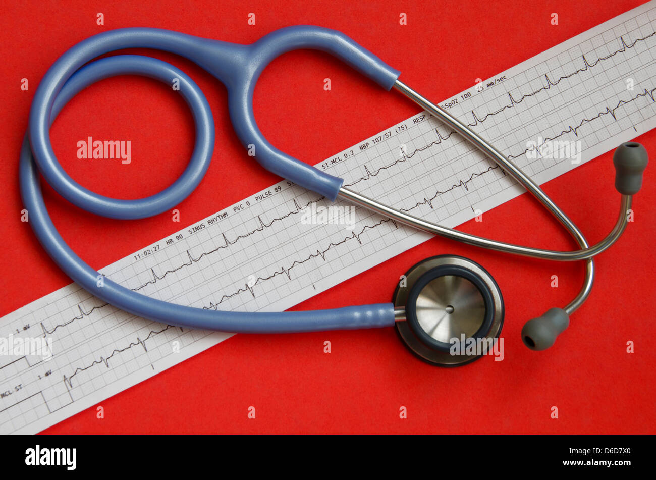 Electrocardiogram ekg graph printout hires stock photography and