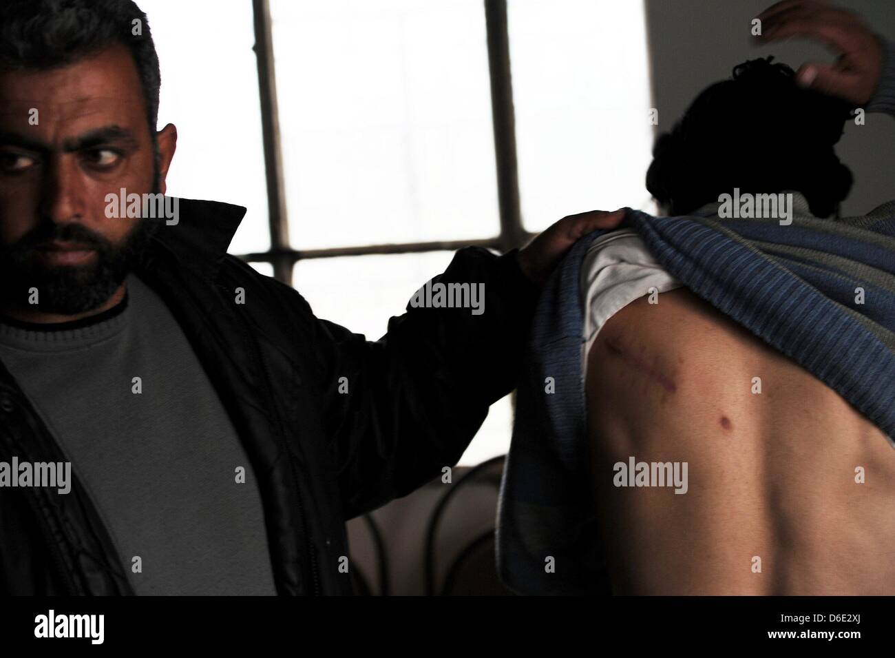 DARKOUSH, SYRIA: A Free Syrian Army leader showing the scars of one soldier who was injured by the govenment army on April 16, 2013, in Darkoush, Syria. A team of 45 medical personnel arrived in Syria on April 14, 2013, to assist in the Gift of the Givers Hospital. (Photo by Gallo Images / Foto24 / Felix Dlangamandla) Stock Photo