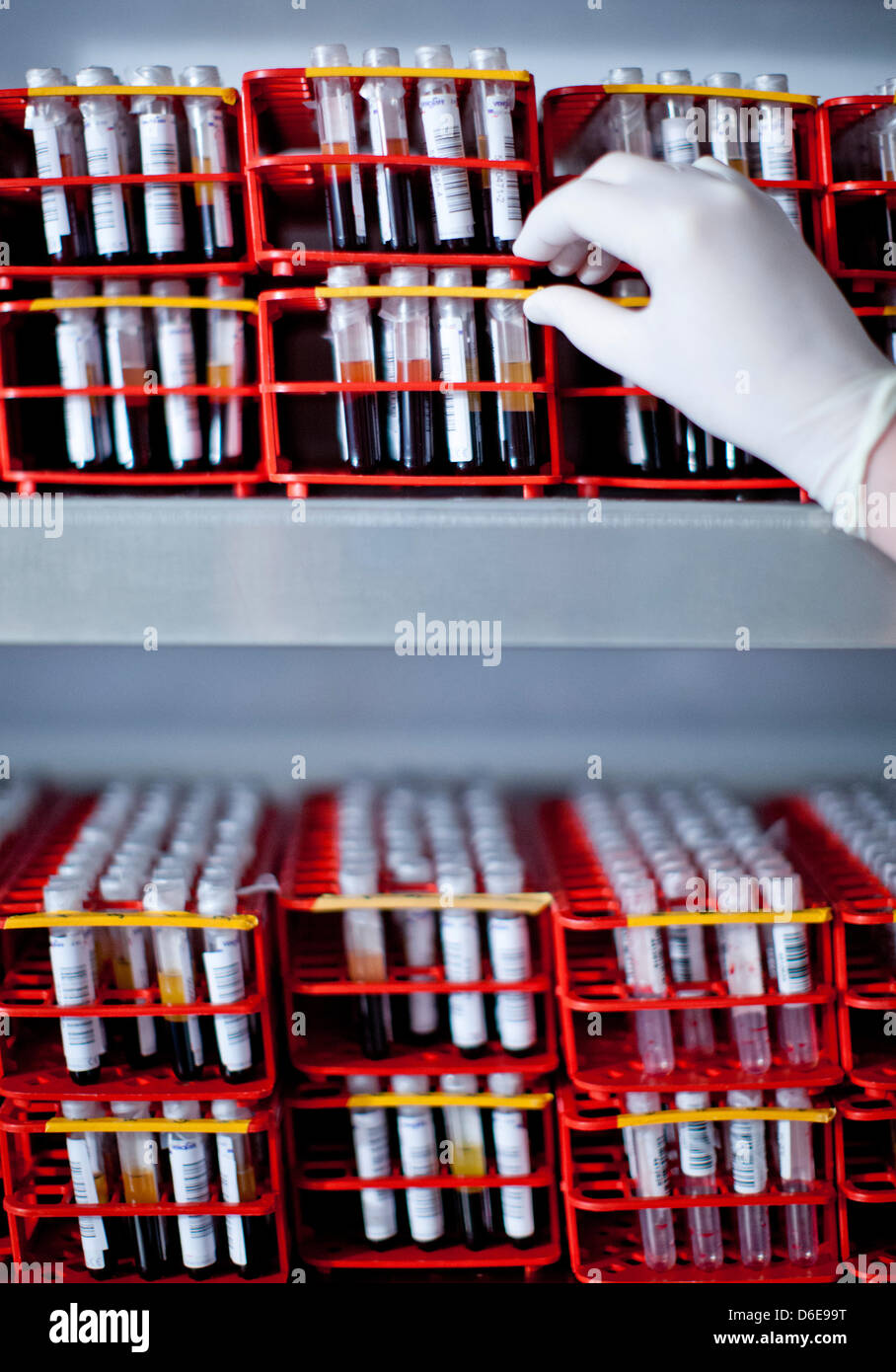 Tissue Typing Lab Staff member tissue typing laboratory hi-res stock photography and ...
