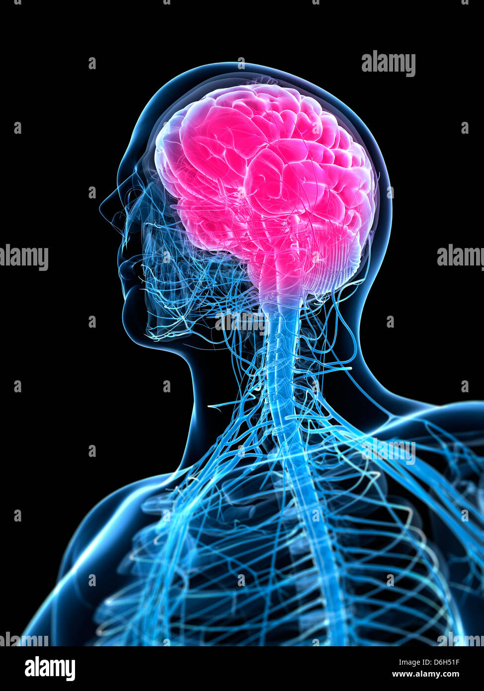 Headache, conceptual artwork Stock Photo