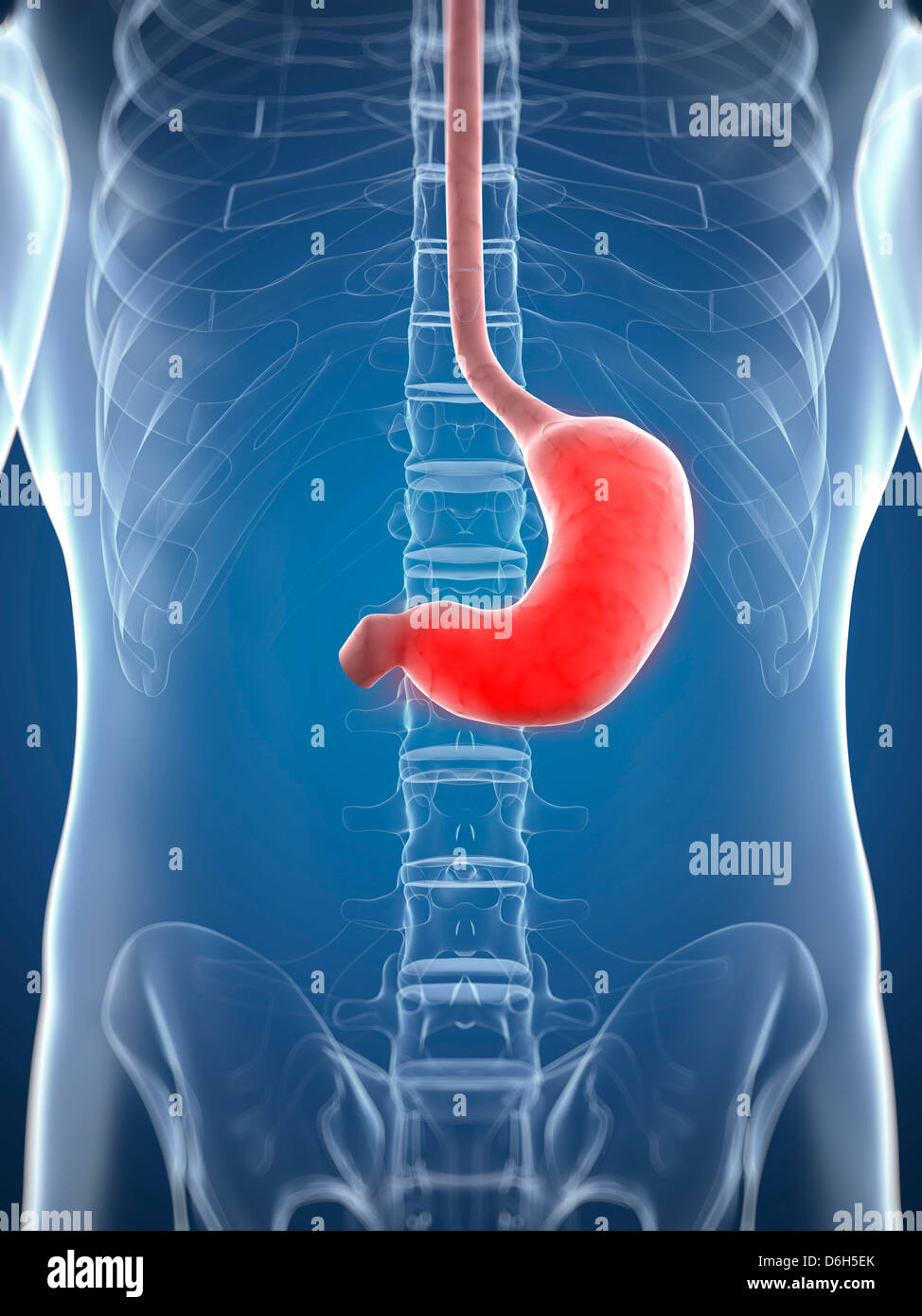 Inflamed stomach, conceptual artwork Stock Photo