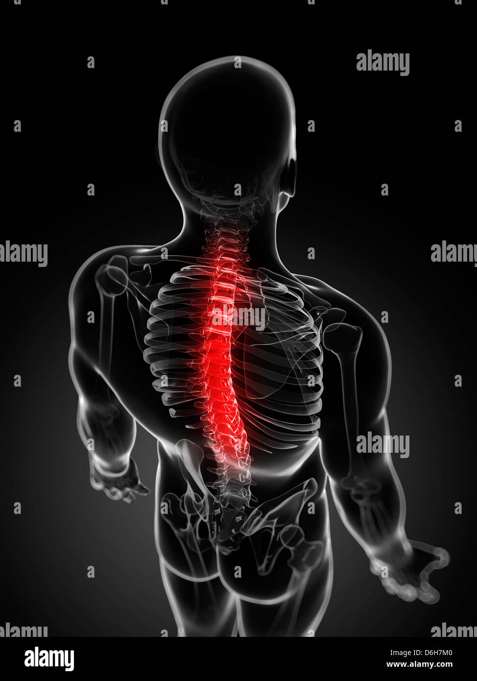 Back pain, conceptual artwork Stock Photo - Alamy