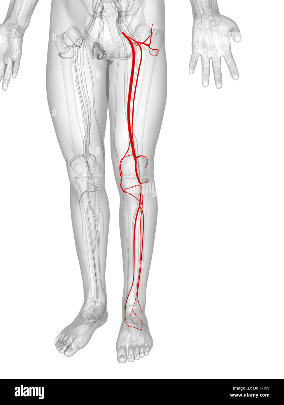 Артерия ноги операция. Шунтирование атеросклероза нижних конечностей. Шунт артерии нижних конечностей. Шунт бедренной артерии. Шунтирование артерия голени.