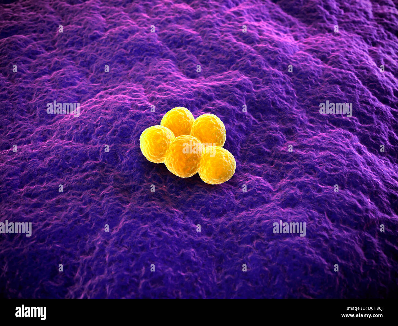 MRSA bacteria, artwork Stock Photo - Alamy