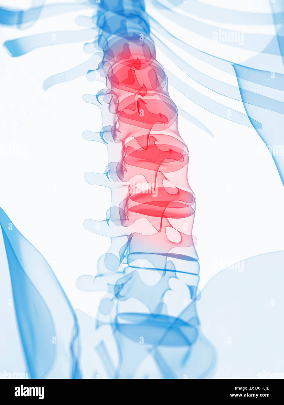 Back pain, conceptual artwork Stock Photo