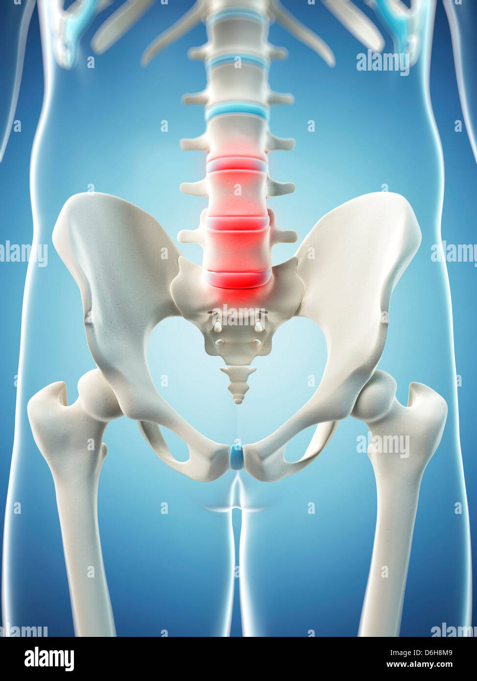 Back pain, conceptual artwork Stock Photo