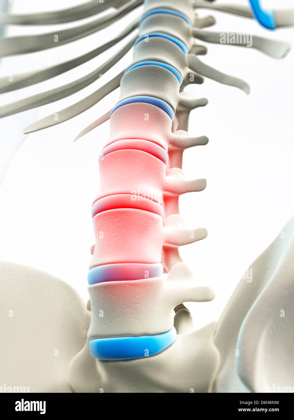 Back pain, conceptual artwork Stock Photo