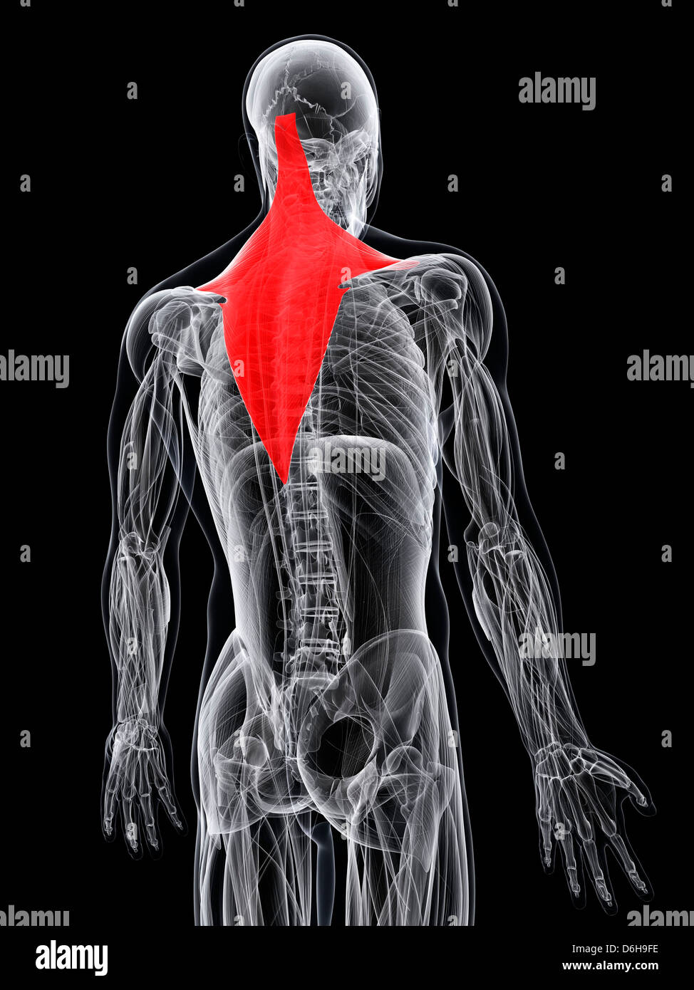 Swollen Trapezius Muscle