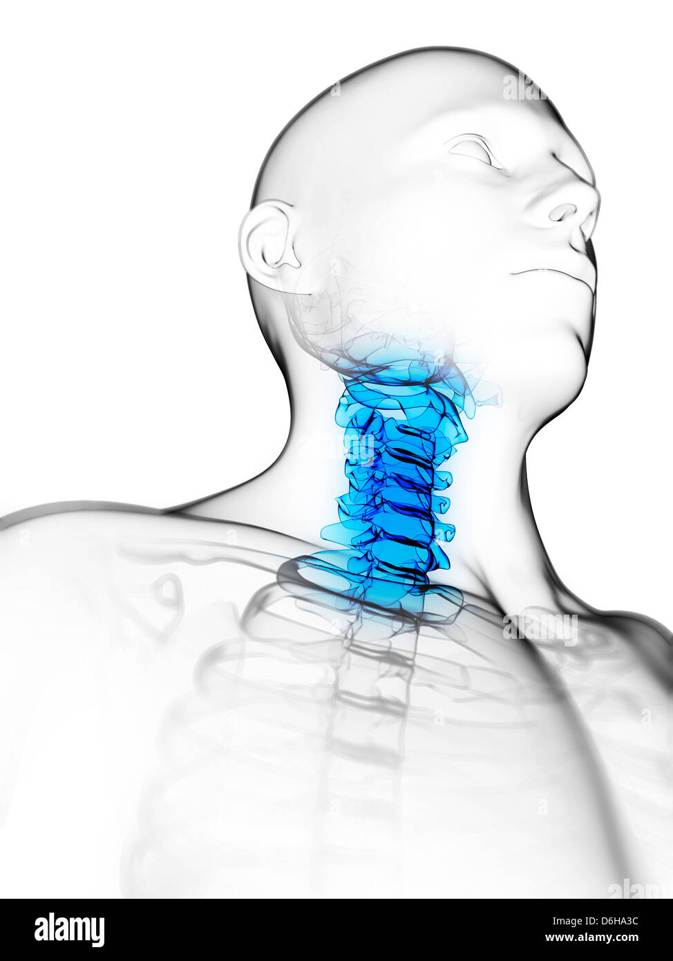 Neck pain, conceptual artwork Stock Photo