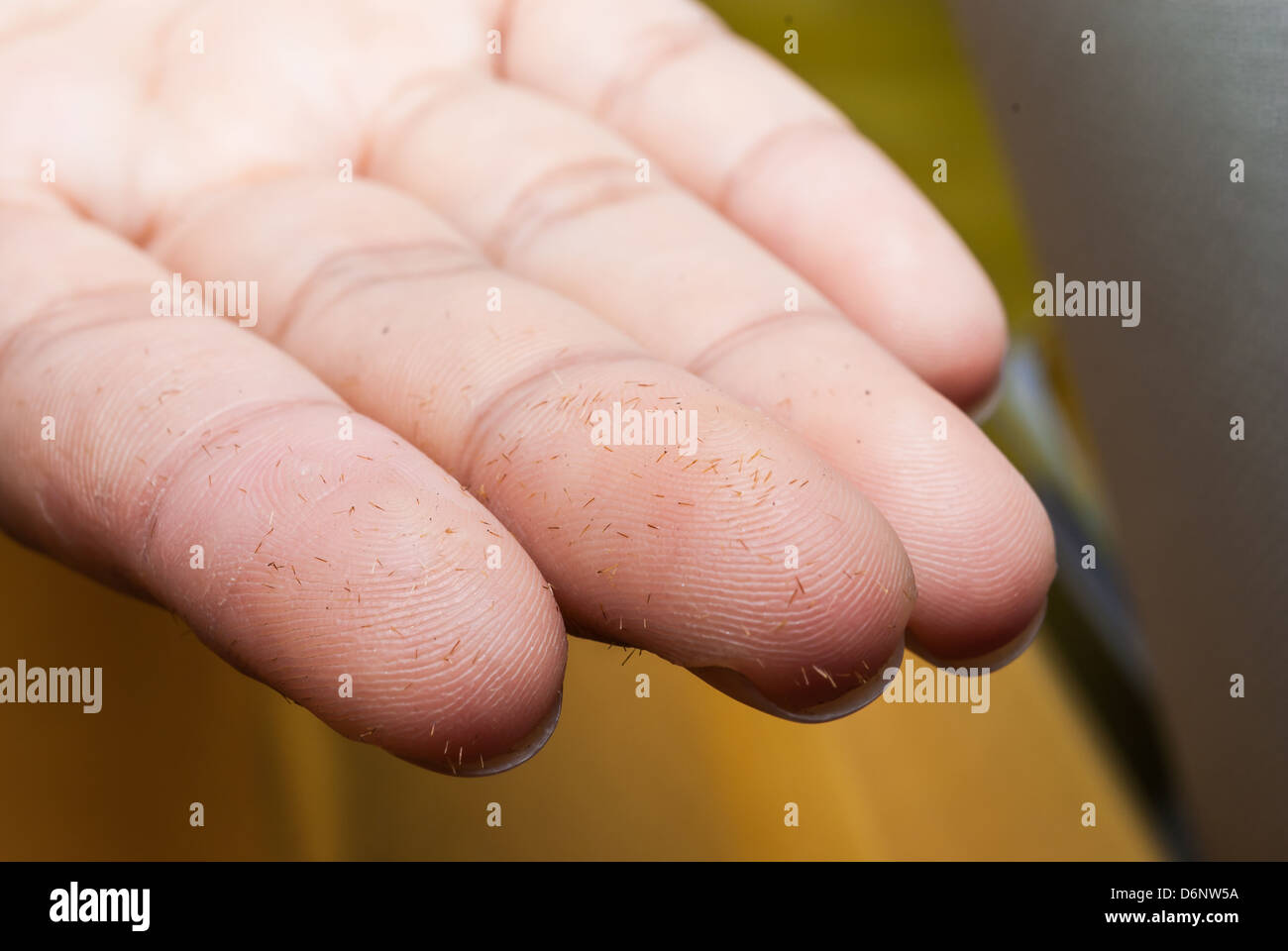 Many thorn on fingers Stock Photo