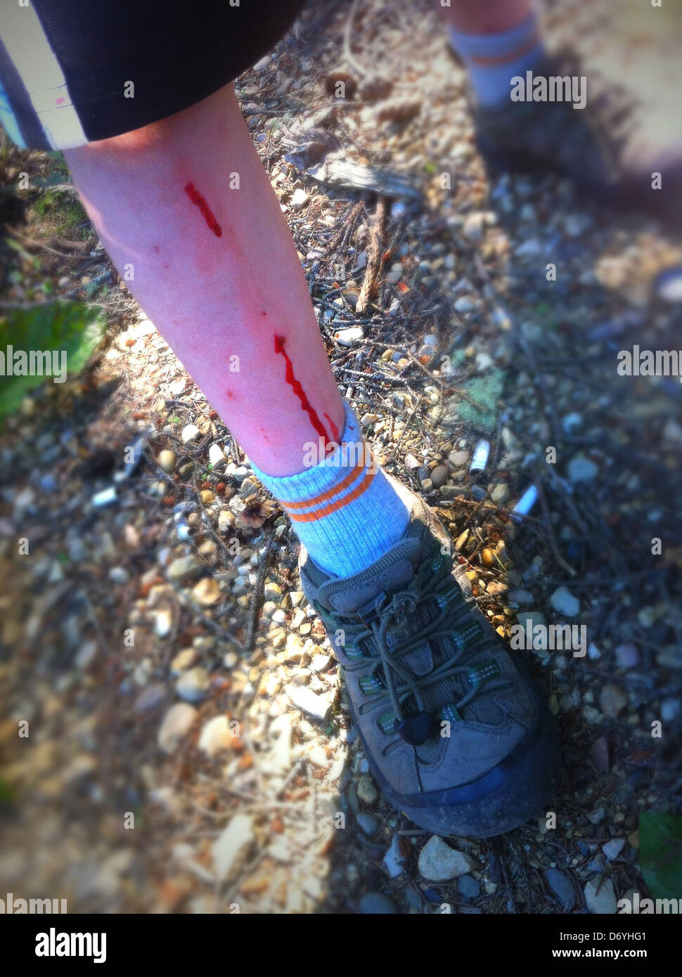 Blood dripping down Caucasian boy's leg - Smartphone Captured Stock Image