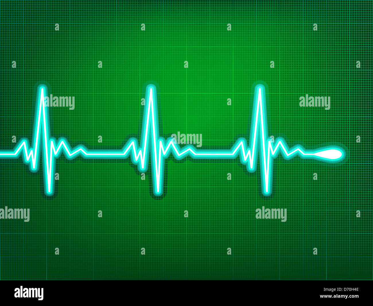 Heart cardiogram with shadow on it deep red Stock Photo - Alamy