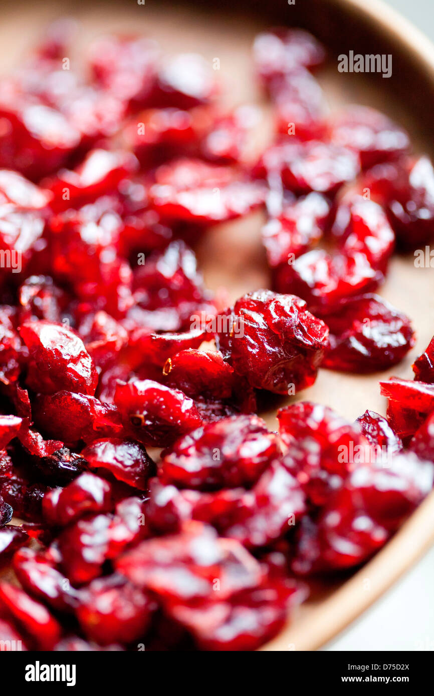 Urinary tract infection uti hires stock photography and images Alamy