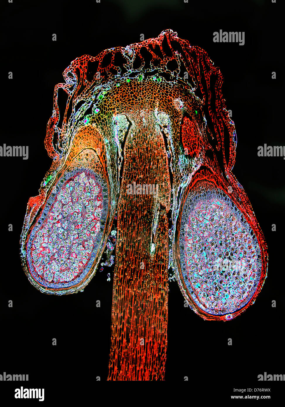 Liverwort Conocephalum sporophyte magnification 40x Stock Photo