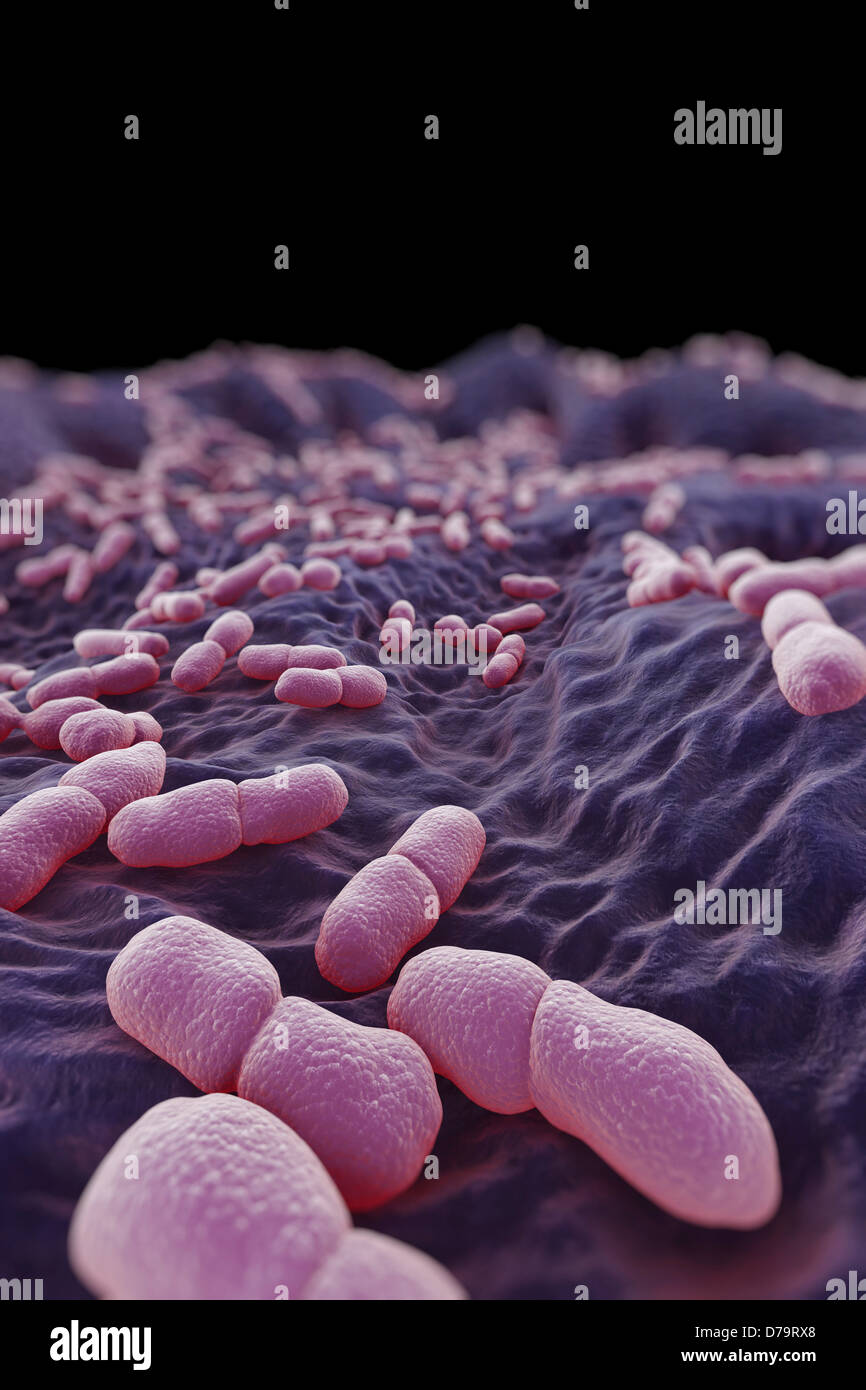 Listeria: A Deadly Foodborne Threat