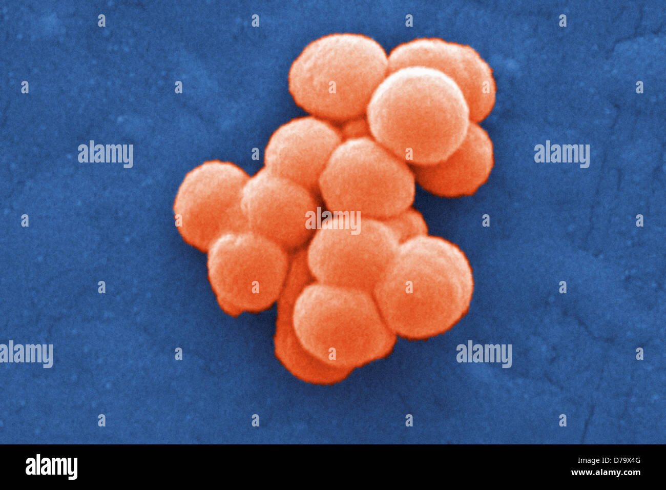 Scanning Electron Micrograph Streptococcus specie Bacteria Stock Photo