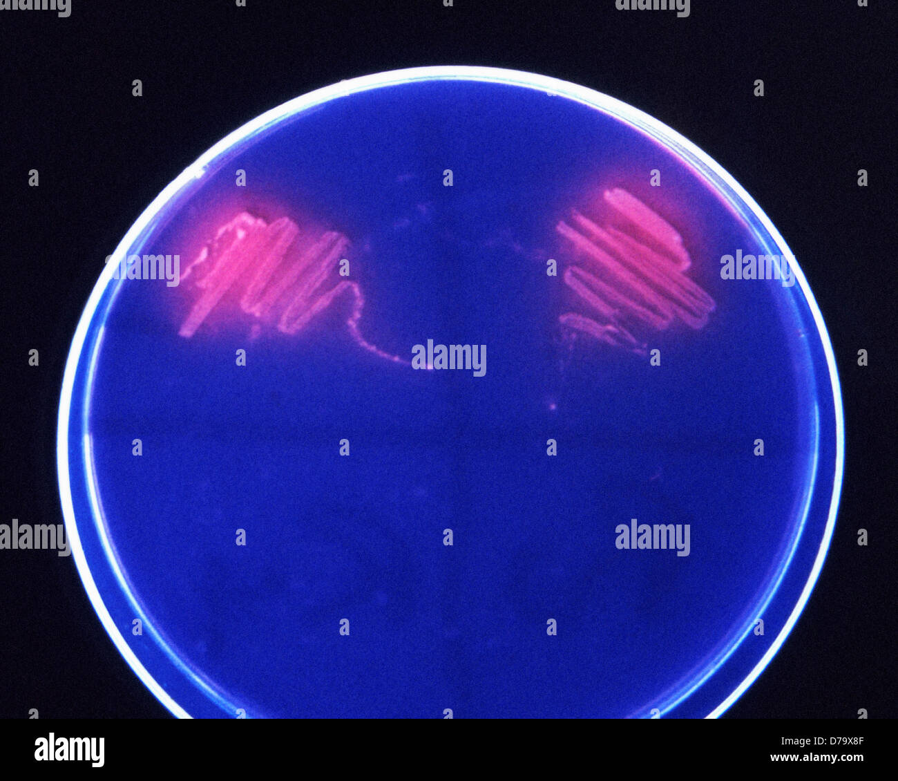 Corynebacterium Minutissimum