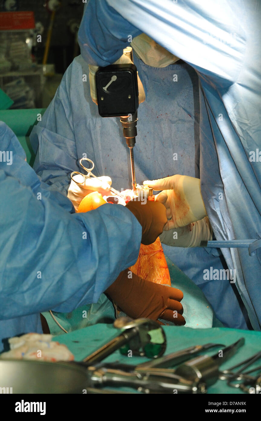 Prosthesis of the knee hospital operation Stock Photo