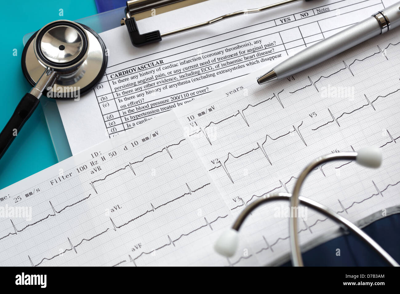 Cardiogram and stethoscope Stock Photo