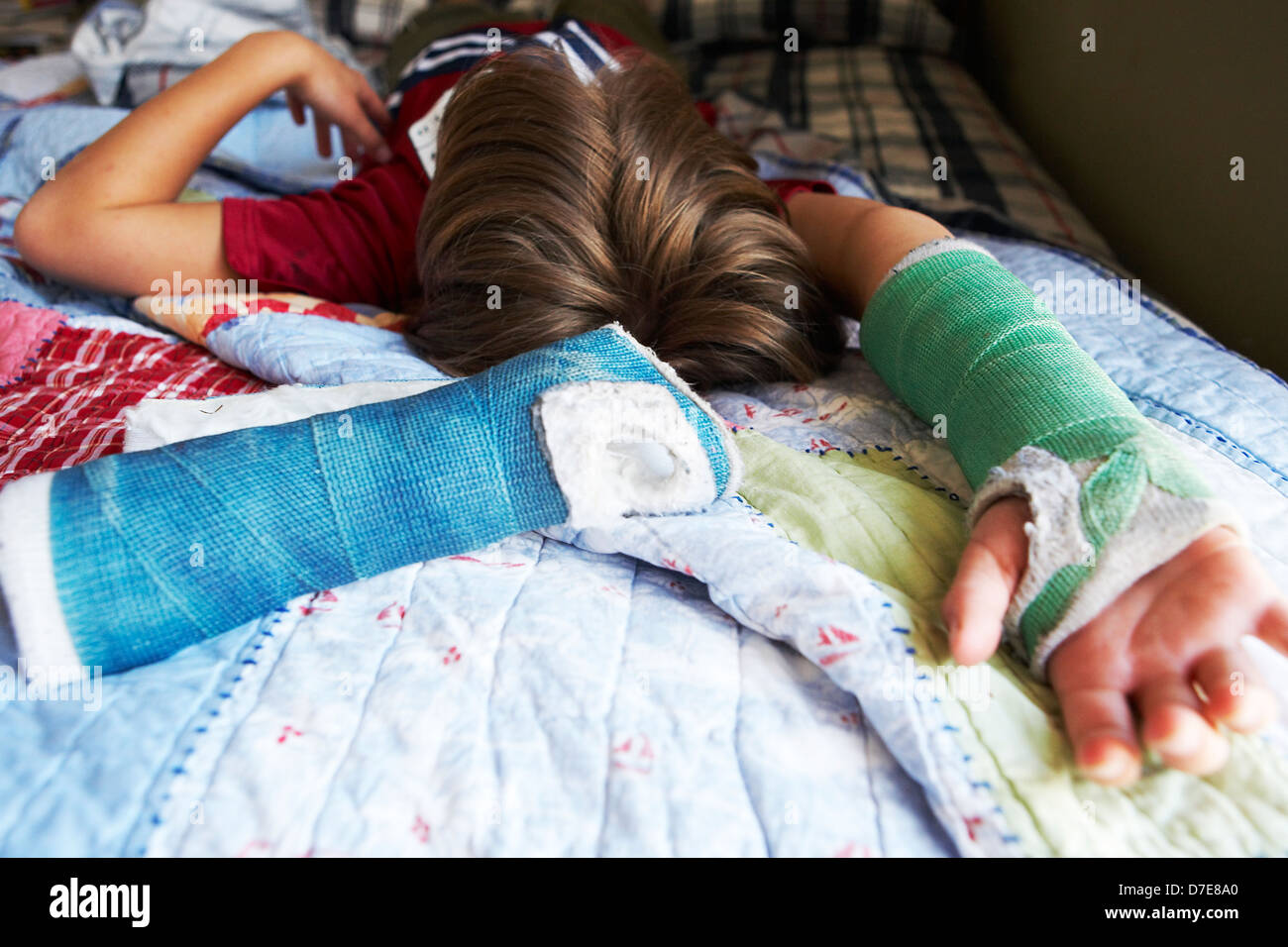 Boy lying in bed with a broken arm Stock Photo Alamy