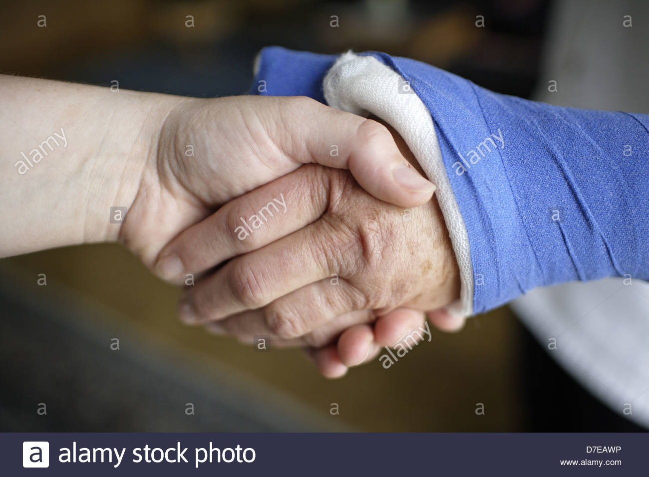 Broken Wrist Stock Photos & Broken Wrist Stock Images Alamy