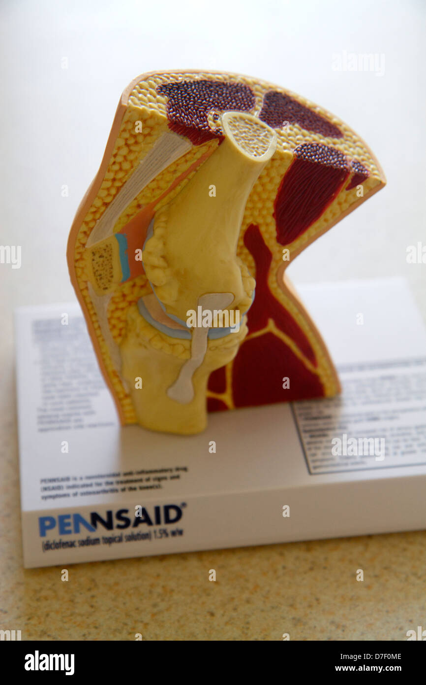 Miami Beach Florida,Mt. Mount Sinai Medical Center,centre,hospital,healthcare,doctor's,examination,guest,room,human anatomy,model,joint,cutaway,knee,F Stock Photo