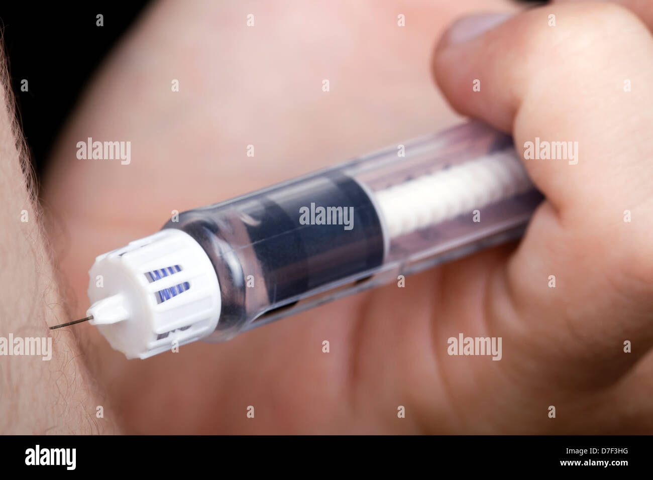 A macro shot of a hand holding a syringe full of insulin about to penetrate the arm of a young adult man with Diabetes. Stock Photo