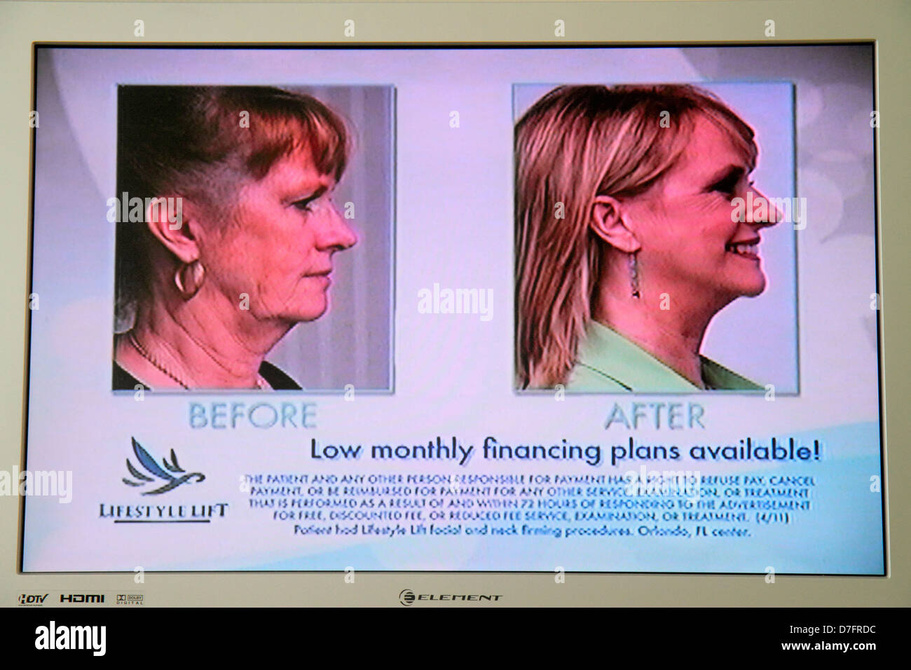 Miami Beach Florida TV television set screen flat panel HDTV monitor