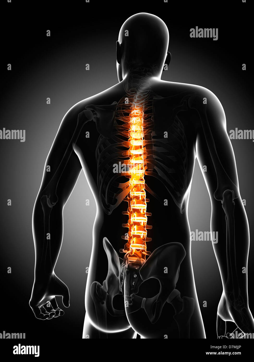 Back pain, conceptual artwork Stock Photo - Alamy