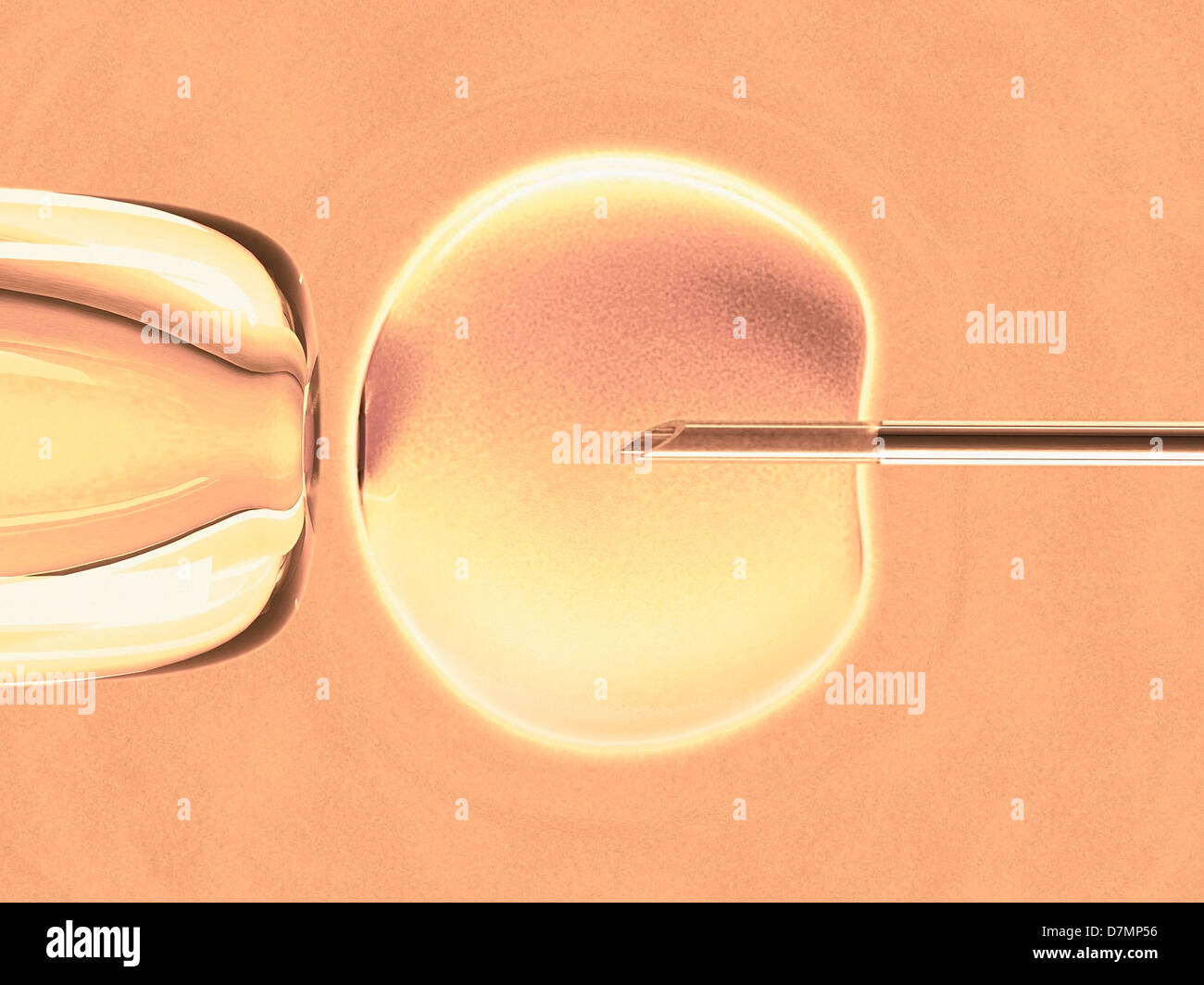 In vitro fertilisation, artwork Stock Photo