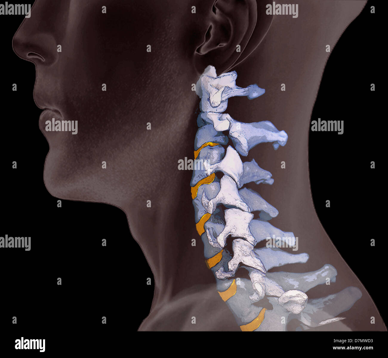 Normal neck bones, 3D CT scan Stock Photo