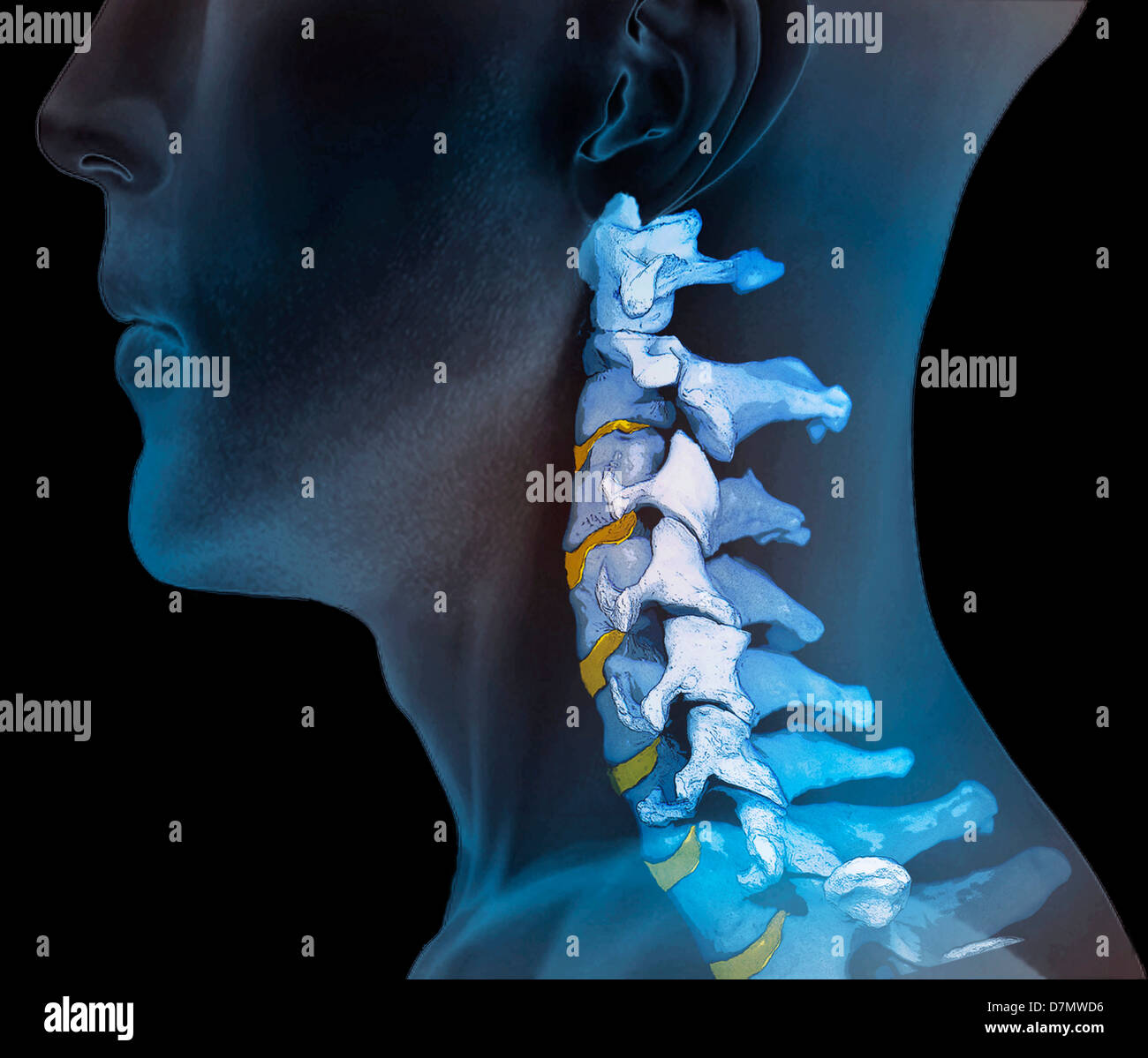 Normal neck bones, 3D CT scan Stock Photo