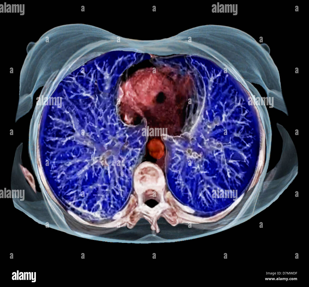 Chest anatomy, 3D CT scan Stock Photo
