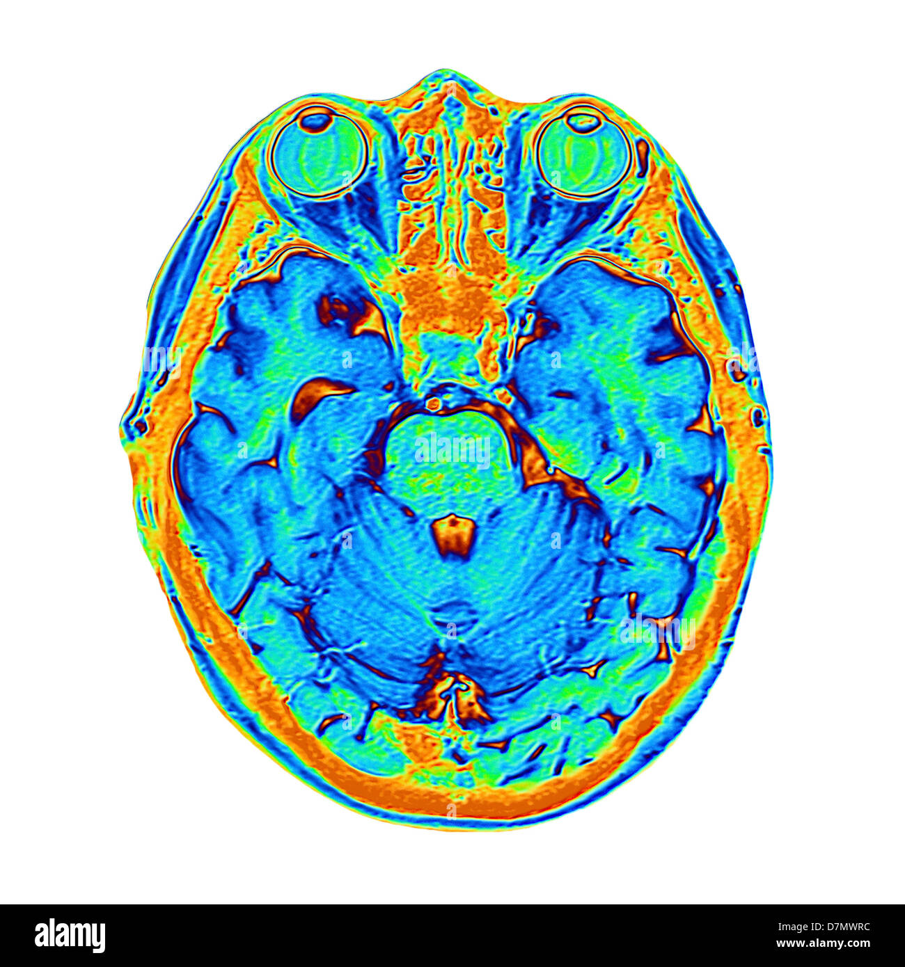 Coloured MRI scan of the human head Stock Photo