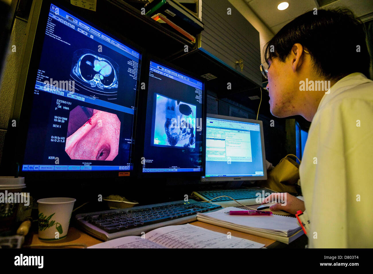 A doctor views endoscopic images, as part of patient diagnosis, in the Reading Room, at a Medical Center. Stock Photo